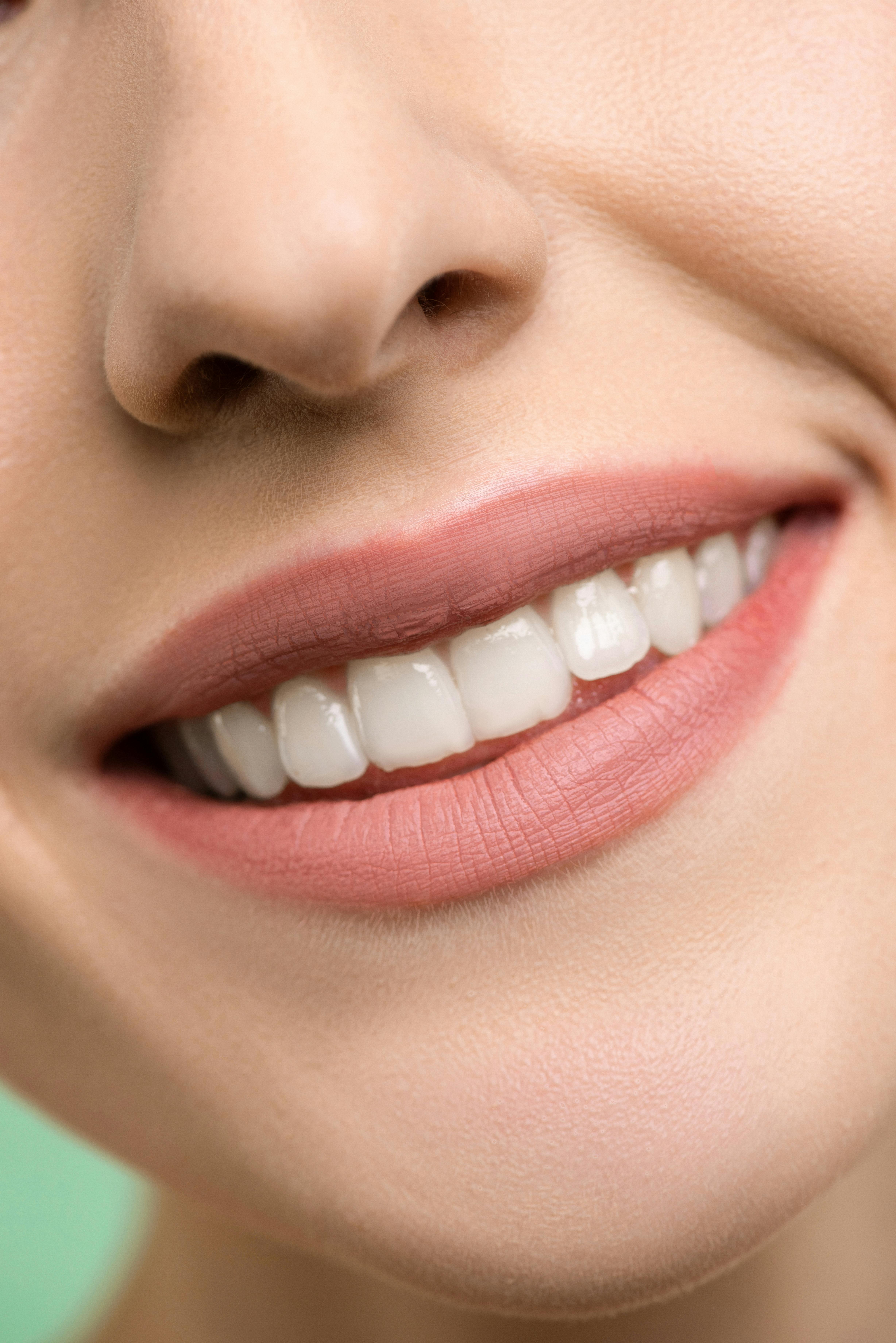 Close de um sorriso renovado